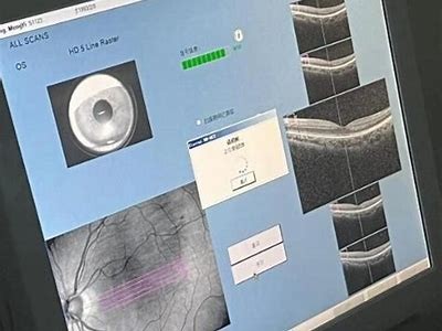 完整解析成人视颅导航技术及运用指南